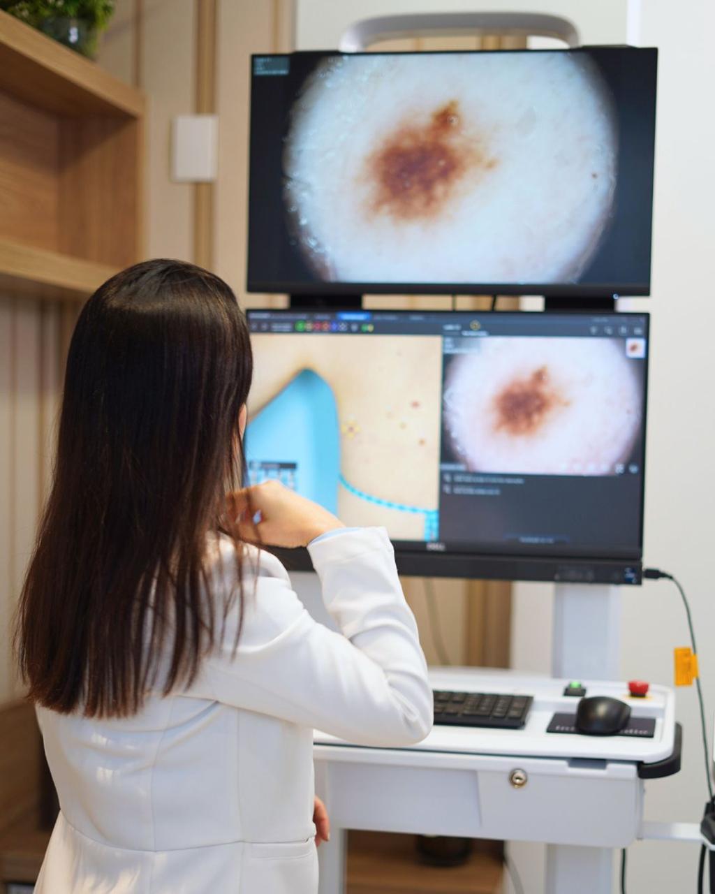 Equipamento dermatoscopia